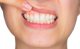 Vitis VITIS GINGIVAL ZESTAW PODRÓZNY 2