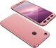 Hurtel 360 Protection etui na całą obudowę przód + tył Xiaomi Redmi Note 5A Prime różowy 1