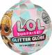 MGA LOL Surprise! Glitter Globe (561620E7C) 1