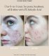PHYTORELAX Alpha-H, Clear Skin, Exfoliating & Toning, Tonic Lotion, For Face, 100 ml For Women 6