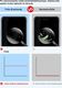 Hurtel Shark Full Body Film antybakteryjna samoregenerująca się folia ochronna na cały telefon (przód + tył) iPhone 11 Pro uniwersalny 20