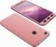 Etui 360 Full Protection na przód i tył do Xiaomi Redmi Note 5A Prime różowe złoto 1